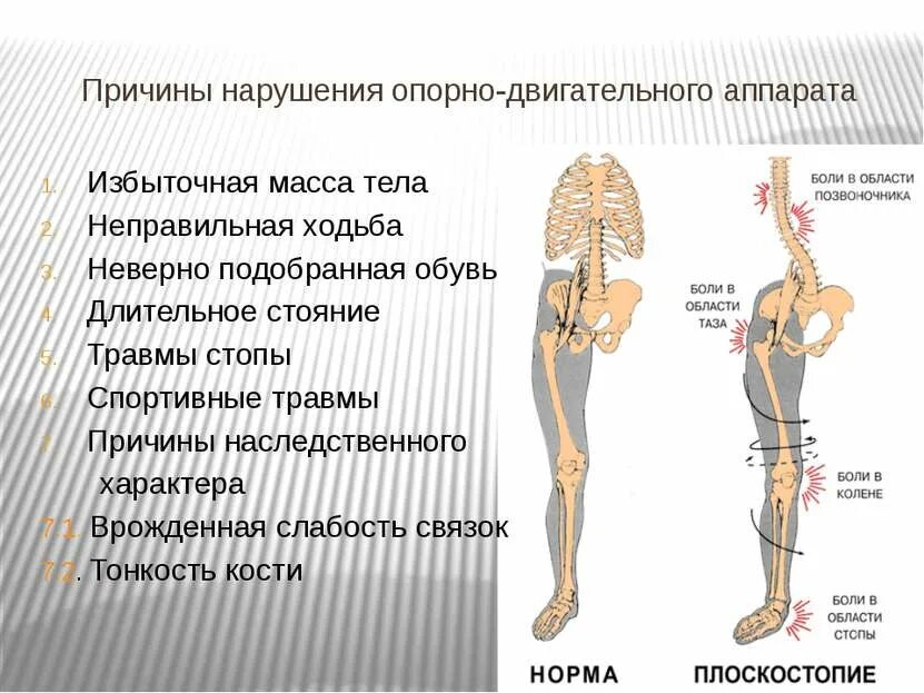 Заболевания опорно-двигательного аппарата у детей. Урок нарушения опорно двигательной системы. Заболевания опорно-двигательной системы. Заболевания опорно-двигательной системы. Причины нарушений опорно-двигательного аппарата.