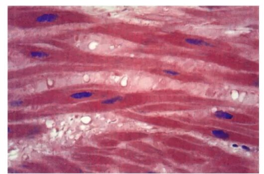 Гладкая мышечная ткань в дерме. Гладкие мышцы под микроскопом. Гладкая мышечная ткань под микроскопом. Гладкомышечная ткань под микроскопом. Мышечная клетка под микроскопом.
