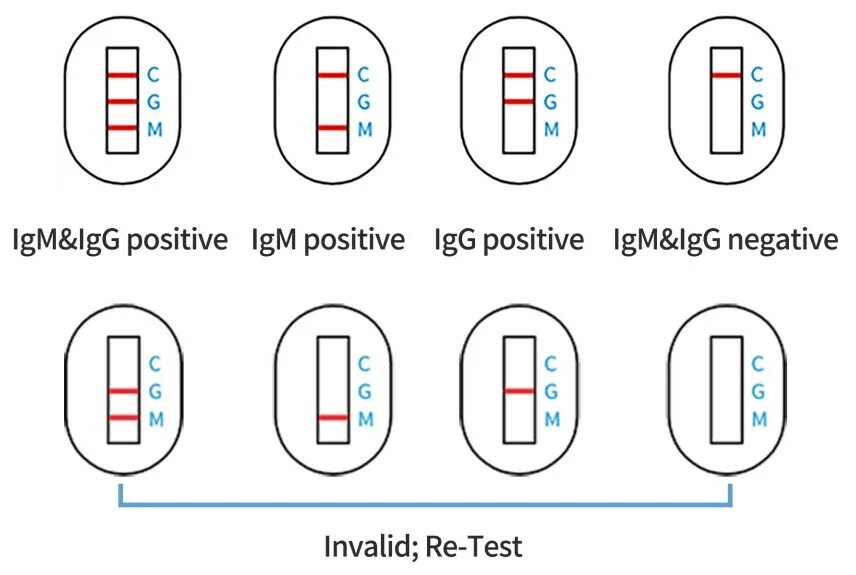 Тест SARS-cov-2 инструкция. Имбиан-SARS-cov-2 IGG/IGM ИХА 1 тест. SARS cov 2 тест. SARS cov 2 экспресс тест расшифровка.