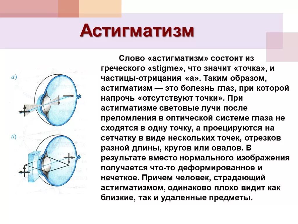 Зрение 10 что значит. Астигматизм роговицы. Болезнь глаз астигматизм. Астигматическое нарушение зрения. Астигматизм это простыми словами.