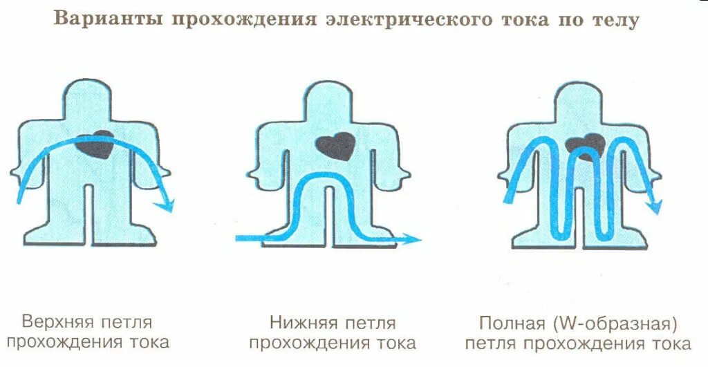 Пути поражения током. Электротравма петля тока. Пути протекания тока (петли тока). Варианты прохождения тока по телу человека. Нижняя петля электротравма.