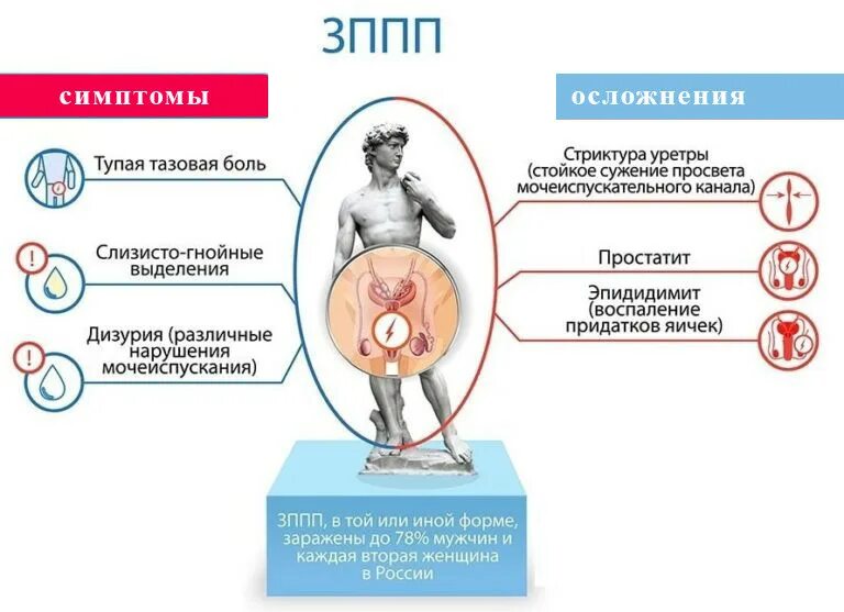 Какие симптомы половых инфекций