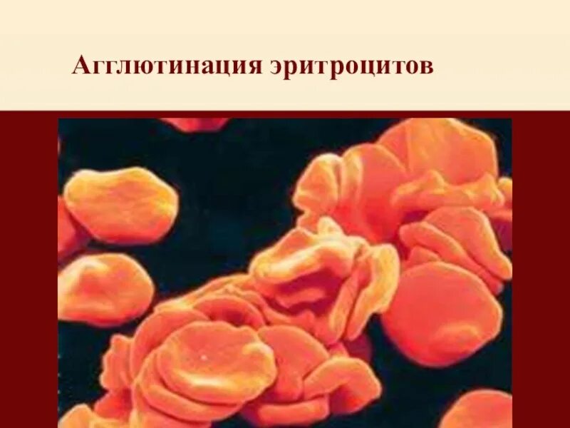 Реакция агглютинации эритроцитов. Агглютинация эритроцитов. Агглютинация это склеивание эритроцитов. Агглютинации эритроцито.