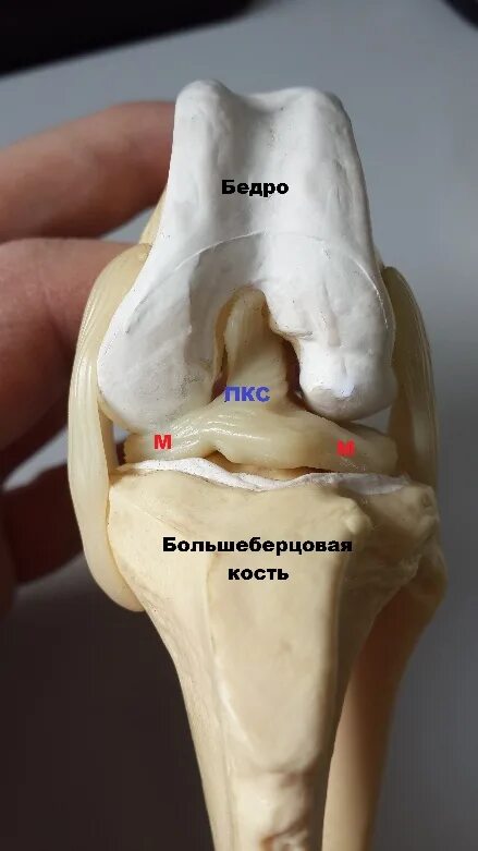 Разрыв связки у собаки. Разрыв ПКС коленного сустава у собак. Передняя крестообразная связка коленного сустава собаки. Разрыв передней крестообразной связки у собаки. Крестовидная связка у собак.