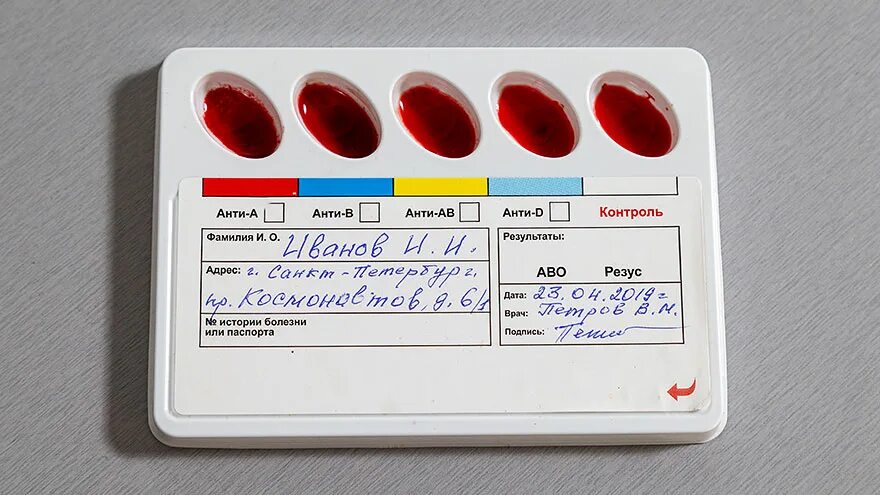 Тест полоски на определение группы крови. Экспресс тест на определение группы крови. Экспресс тест на группу крови в аптеке. Группа крови тест в аптеке. Анализ группы тест