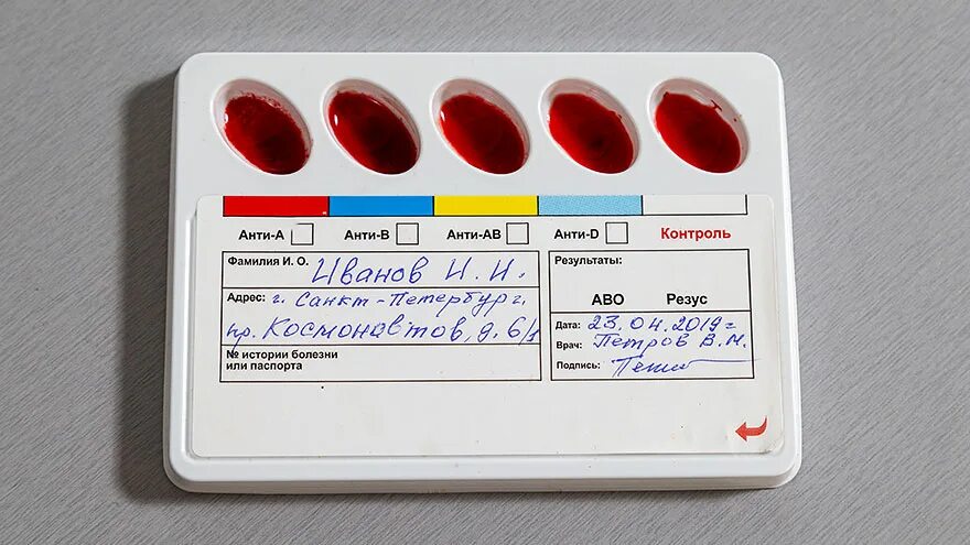 Тест полоски для определения группы крови и резус фактора. Экспресс тест на группу крови в аптеке. Экспресс тест на резус-фактор. Группа крови тест в аптеке. Группа крови и резус инвитро