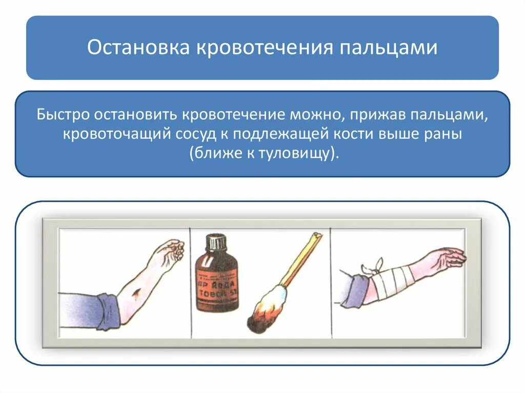 Как остановить сильную кровь. Как основать кровотечение. Как остановитьткровотечение. Как Остановить кровотечение. КСК Остановить кровотечение.