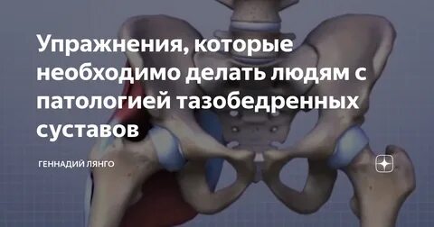 Что нельзя делать при коксартрозе