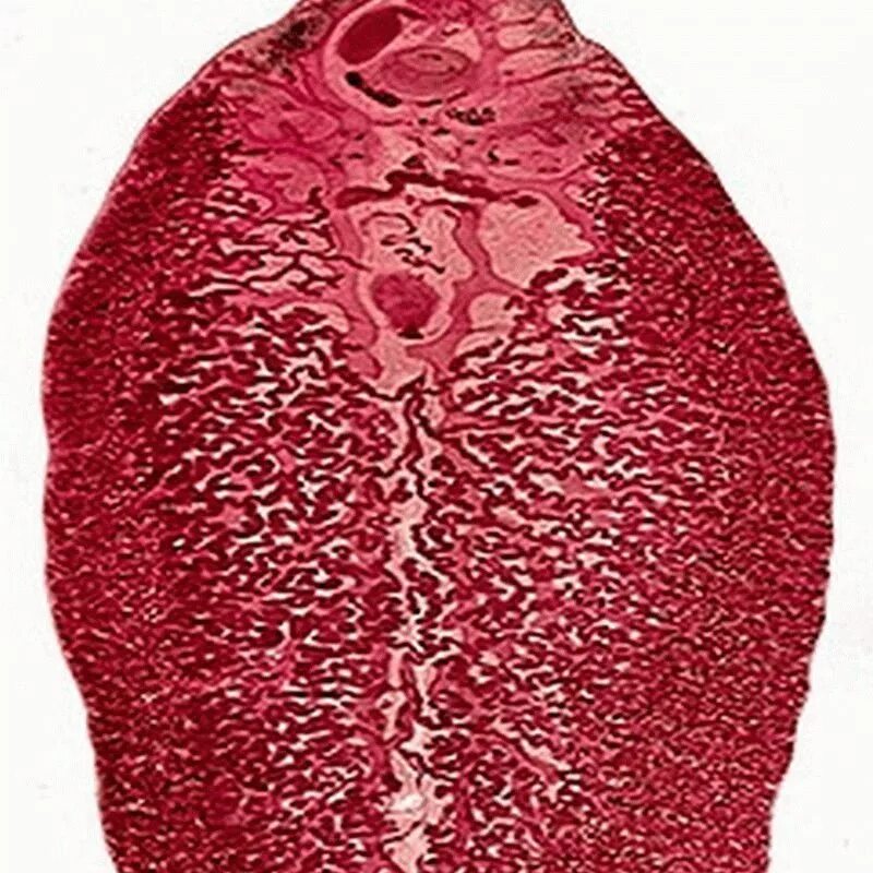 Двуустка печеночный сосальщик. Печеночный сосальщик фасциола. Фасциола печеночная.