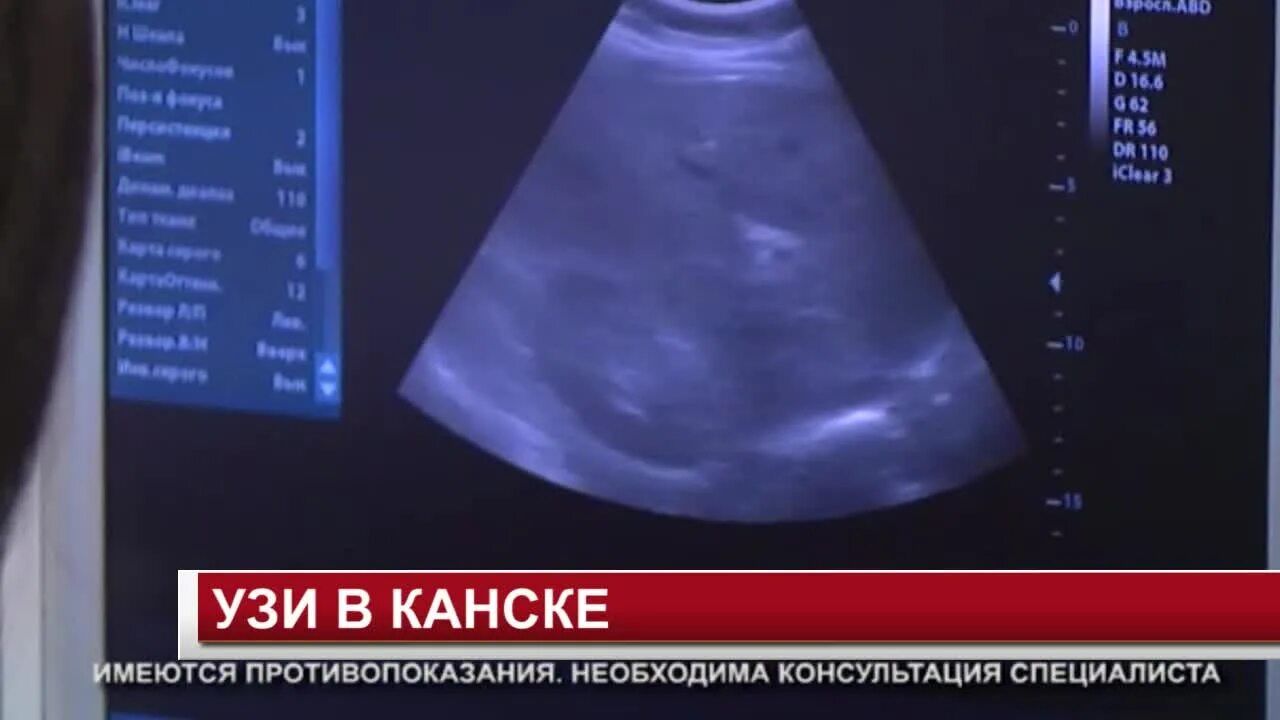 Узи сосудов в абакане. Узи сосудов нижних конечностей. Узи сосудов в абакане. Узи сосудов в абакане. Узи сосудов почек.