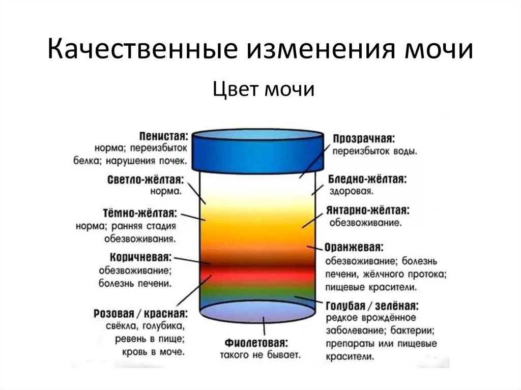 Изменение цвета мочи. Что изменяет цвет мочи. Изменение цвета мочи патологии. Изменение цвета мочи при патологии. Моча пахнет и желтая