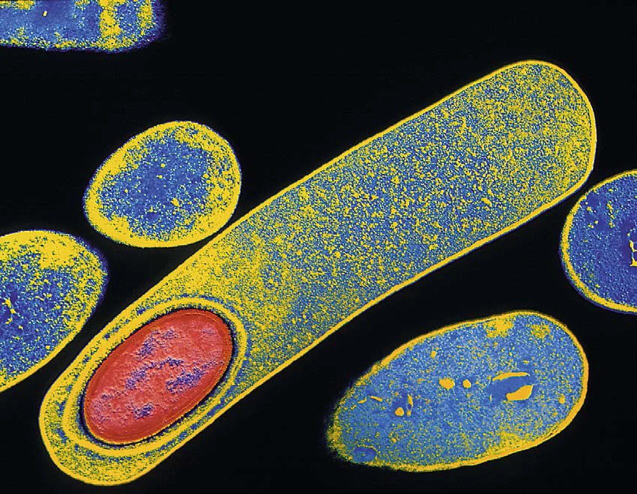 Clostridium difficile что это. Клостридиум диффициле. Clostridium difficile микробиология. Clostridium butyricum. Клостридии ботулинум Токсин.