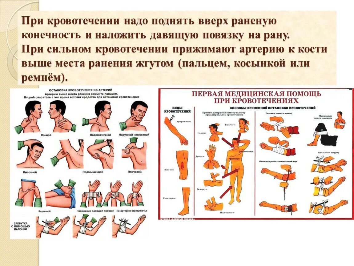 Оказание первой помощи при переломах и кровотечениях. Оказание первой медицинской помощи при ранениях и закрытых травмах. Оказание ПМП при травмах и ранениях. Оказание первой помощи при ранениях и кровотечениях. Оказание первой помощи при ушибах и ранениях.