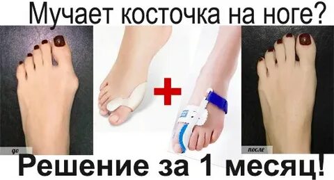 Растет косточка что делать
