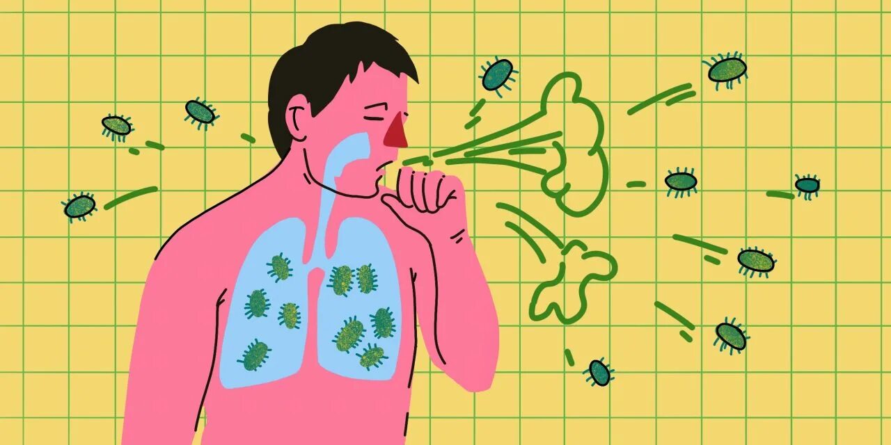 Коклюш передается воздушно капельным путем. Коклюш передается воздушно капельным путем. Коклюш это инфекционное заболевание. Коклюш инфекционные болезни. Коклюш профилактика.