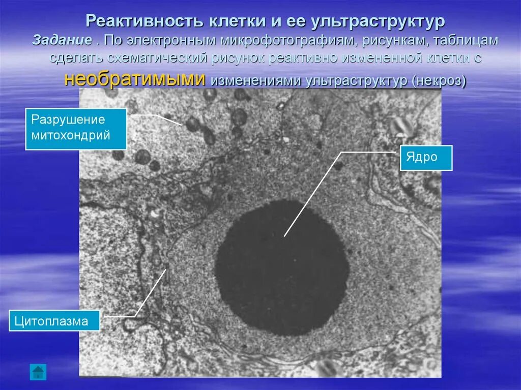 Рефрактивность клетки. Реактивность клеток. Электронная микрофотография клетки. Ультраструктура клетки.