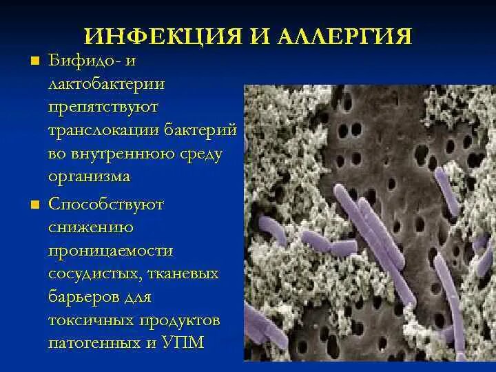 Бифидобактерии бифидум микроорганизмы. Микроскопия бифидобактерии бифидум. Бактерии полезные для человека бифидобактерии. Какие бифидобактерии