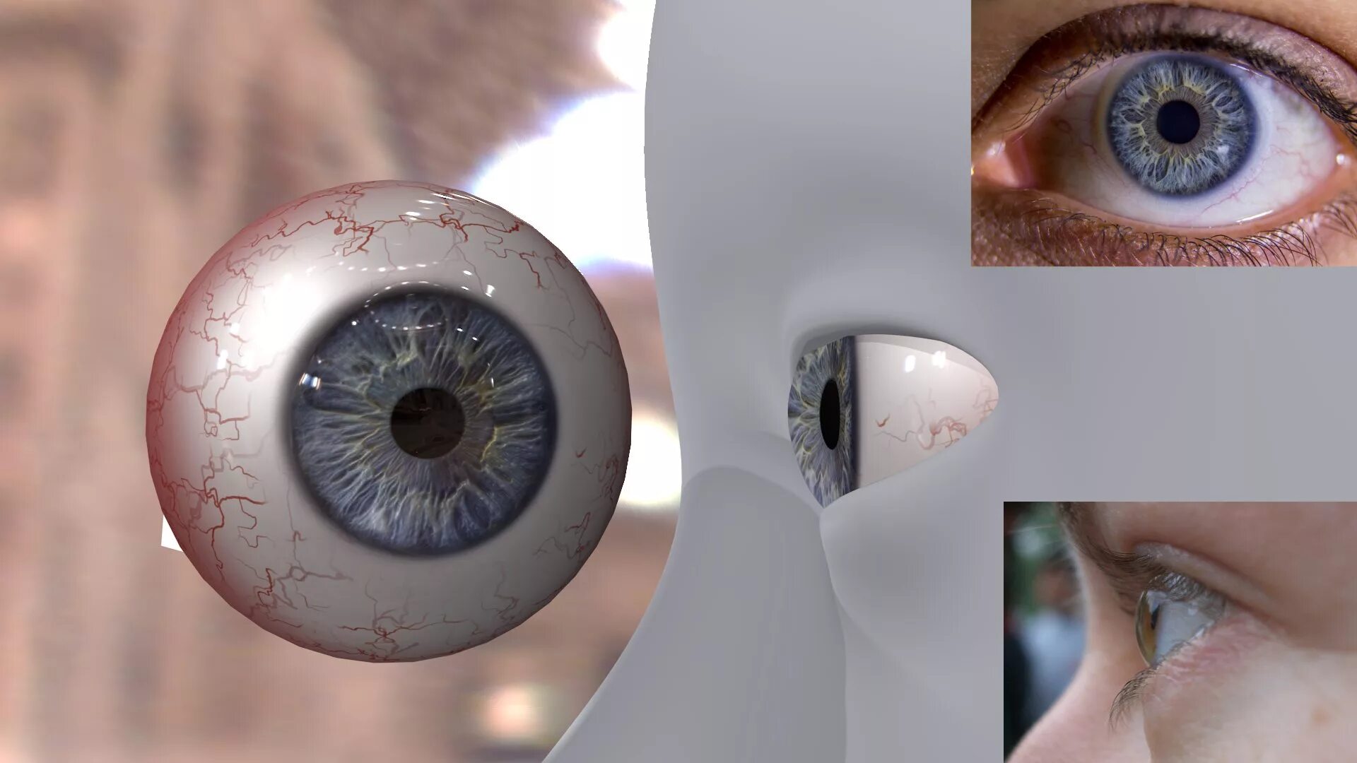 Аргус 2 бионический глаз. Склеральные линзы кератоконус. Глазной протез Argus 2. Стеклянный глаз протез. Глаза давят внутри