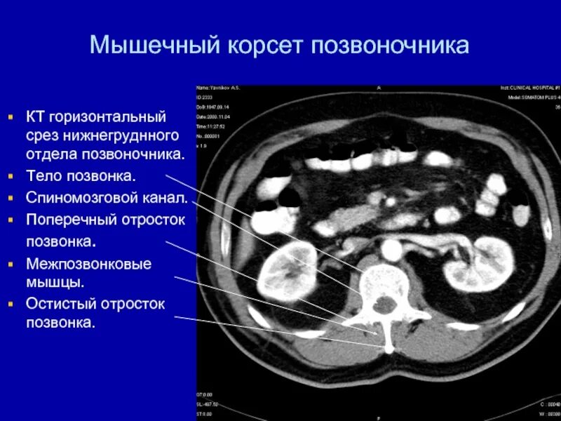 Диагнокад срезы кт. Патологии легких на кт. Аксиальная кт. Срезы кт. Легкие кт анатомия.
