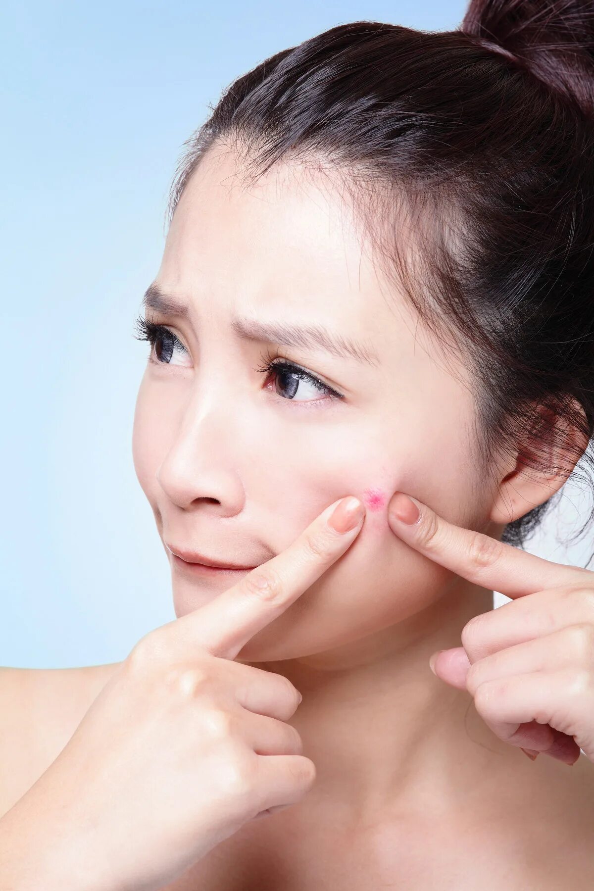 Cares acne skin care. Cares acne skin care. Cares acne skin care. Девушка с безупречной кожей. Cares acne skin care.