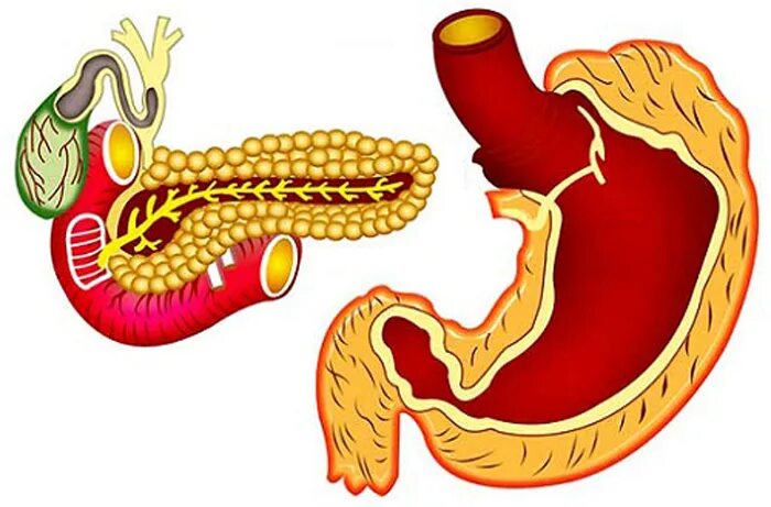 Панкреатит и язва желудка. Гастрит панкреатит поджелудочной железы. Гастрит язва панкреатит. Гастрит, язвенная болезнь, панкреатит.