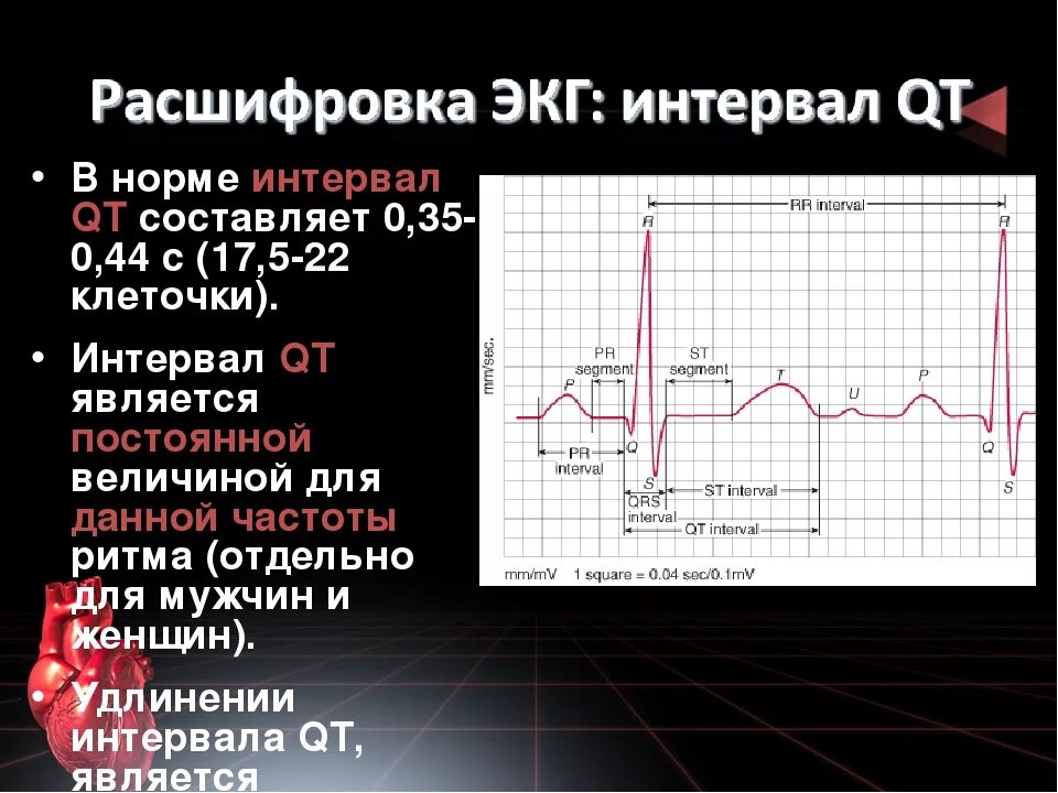 Удлинение корригированного qt интервала свыше 450