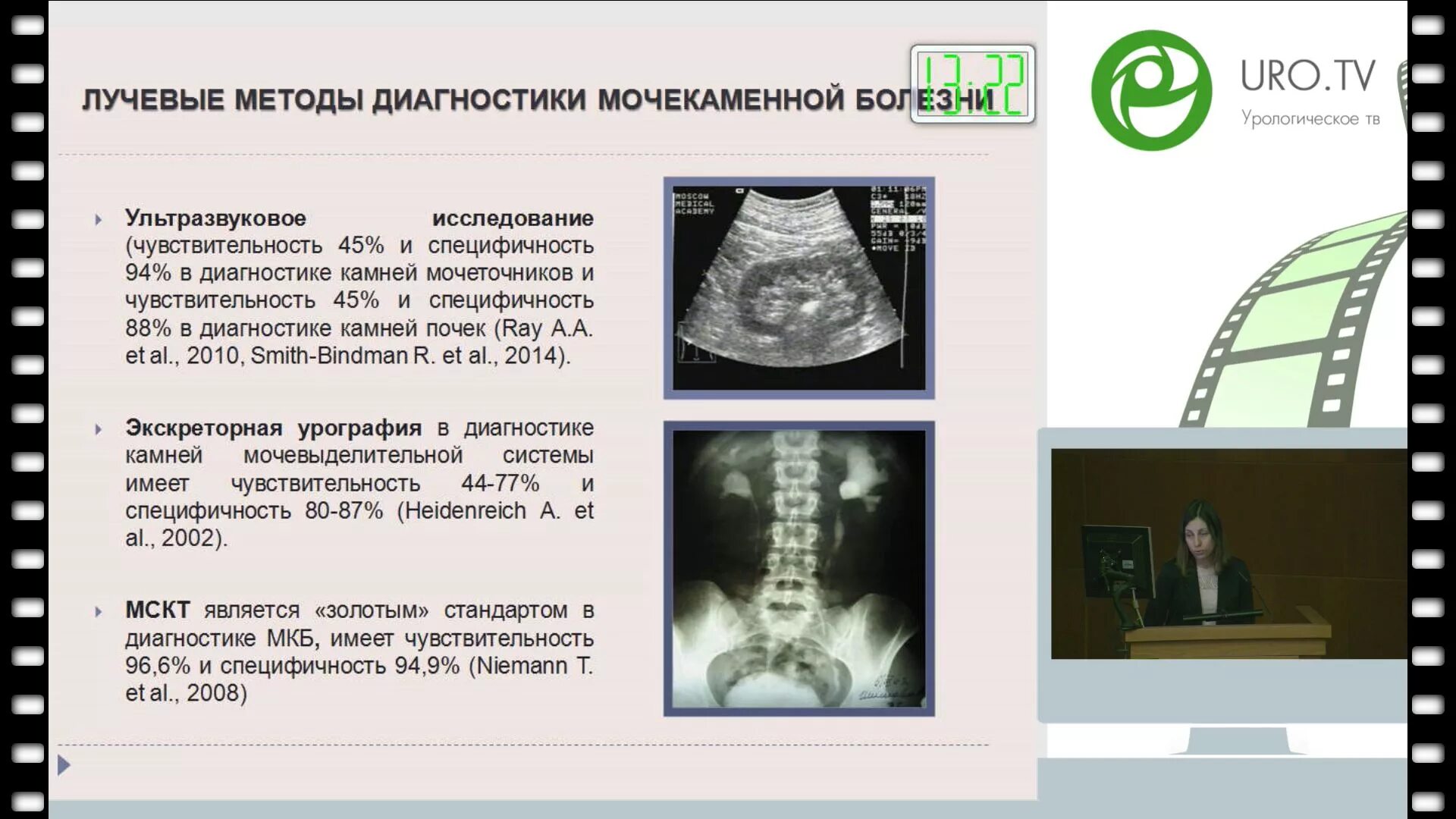 Узи почек диагнозы. Инструментальный метод исследования мочекаменной болезни. Инструментальные методы исследования при мочекаменной болезни. Мочекаменная болезнь алгоритм лучевых методов исследования. Лучевые симптомы мочекаменной болезни.