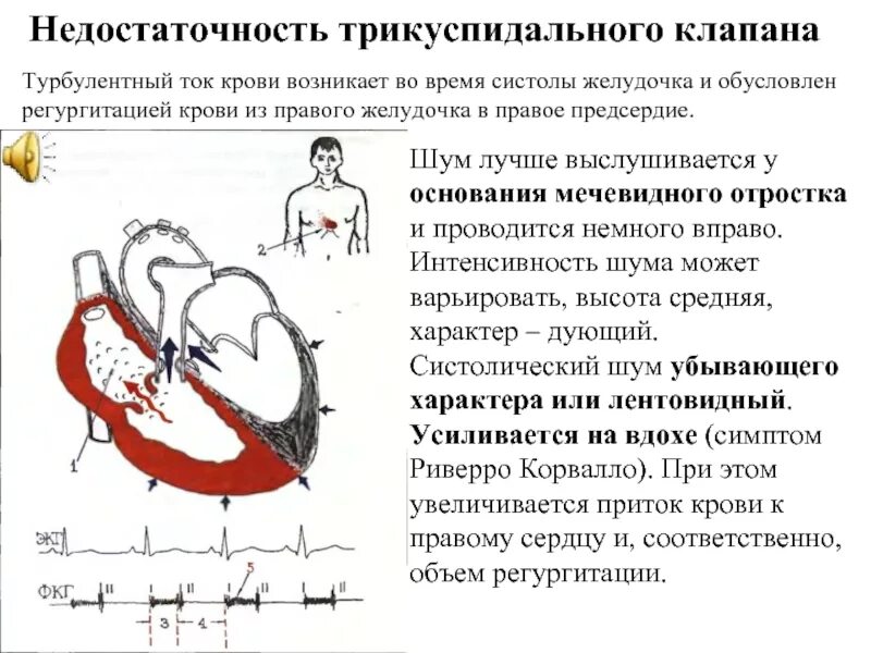 Систола и диастола сердца. Систола и диастола желудочков. Систола и диастола сердца. Что такое систола сердца. Схема систолы и диастолы сердца.