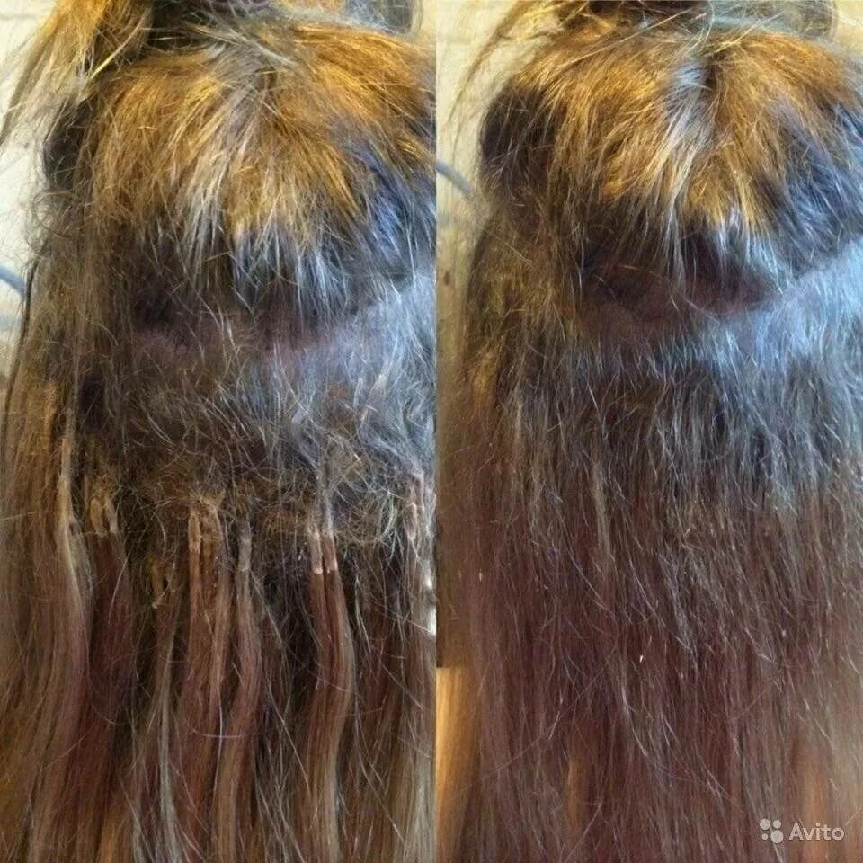 Как сохранить волосы после. Волосы после снятия нарощенных. Некачественное наращивание волос. Нарощенные волосы после. Наращивание волос до и после.