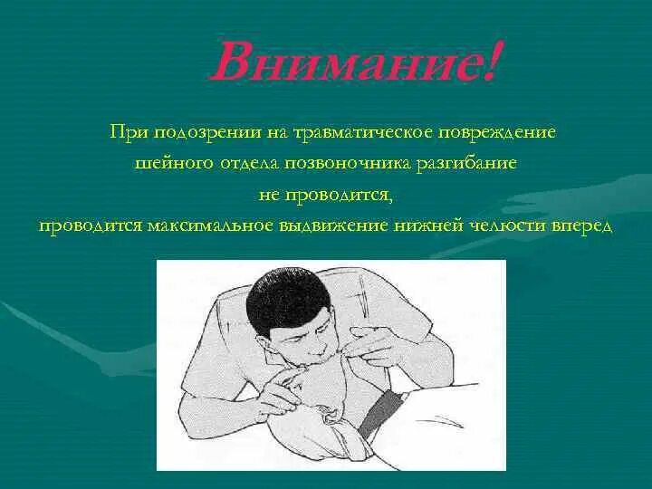 При подозрении на повреждение шейного отдела позвоночника. При подозрении на травму позвоночника. Сердечно легочная реанимация при переломе шейных позвонков. Доврачебная помощь при травме шейного отдела позвоночника.