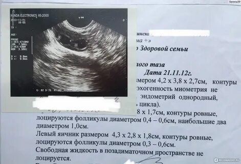 Узи фолликула что это