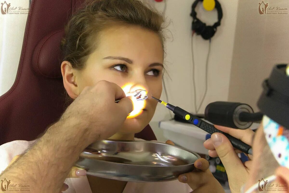 Радиоволновая полипотомия носа что это. Полипотомия носа операция. Удаление полипов в носу шейвером. Эндоскопическая полипотомия носа. Удалить полипы в носу лазером.