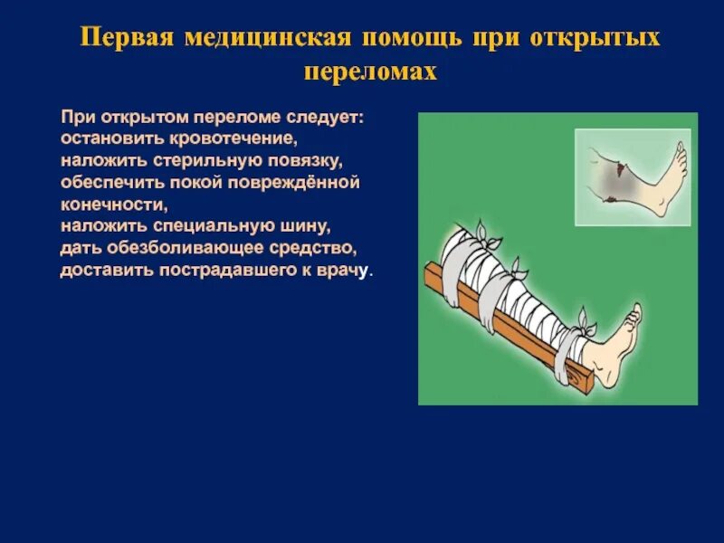 В случае открытого перелома. Повязка при открытом переломе. Кровотечение при открытом переломе. Первая медпомощь при переломах.