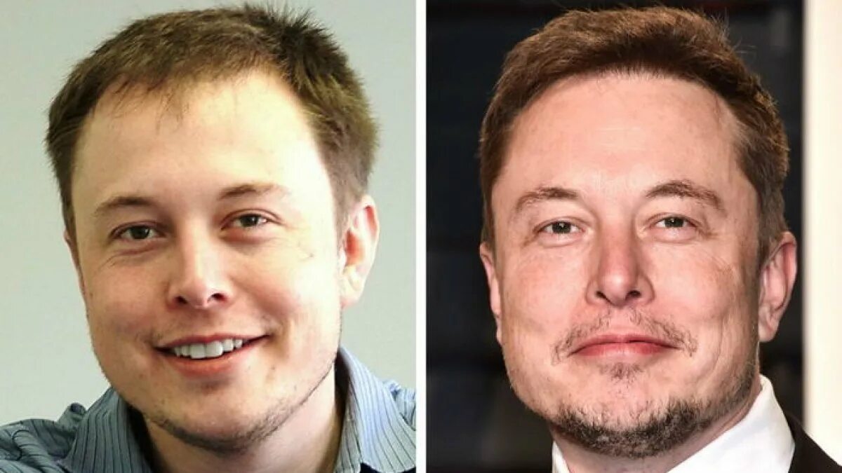Илонимаск в молодости. Илон маск волосы. Павел дуров до пластики. Павел дуров в молодости. Павел дуров до и после.