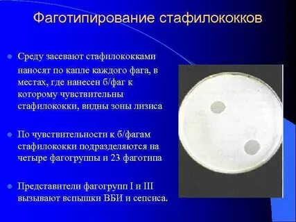 Метод фортнера
