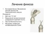 Воспалена крайняя плоть. Воспалена крайняя плоть