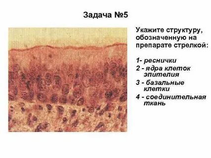 Эпителиальные ткани образованы клетками