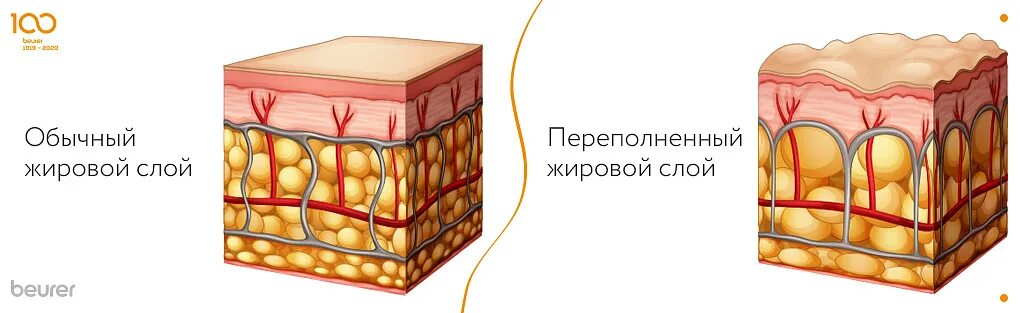 Подкожно жировая клетчатка ткань. Гиподерма это подкожная жировая клетчатка. Функции кожи и подкожно-жировой клетчатки. Подкожно жировая клетчатка строение и функции. Жировая ткань строение.