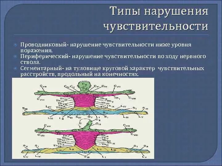 Типы поражения чувствительности неврология. Сегментарный Тип расстройства. Нарушение чувствительности схема. Типы нарушения чувствительности неврология.