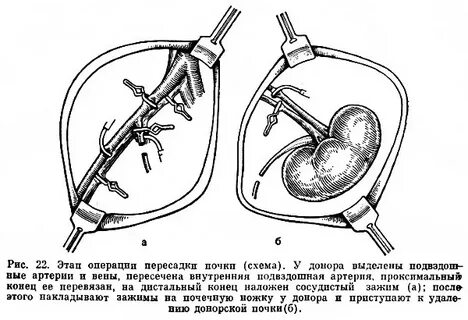 Почки москва
