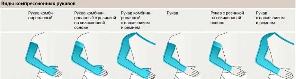 Когда можно снимать компрессионные. Компрессионный трикотаж 2 степени компрессии. компрессионный трикотаж 2 степени рукав. компрессионный трикотаж при лимфедеме верхней конечности. степень компрессии компрессионные рукава.