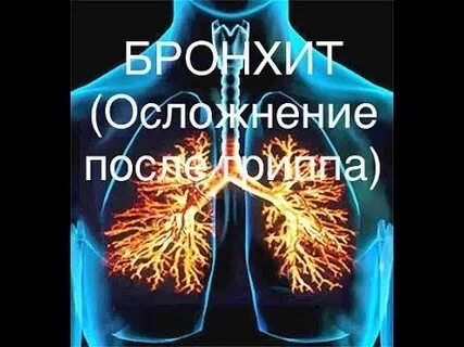 Кашель после бронхита форум