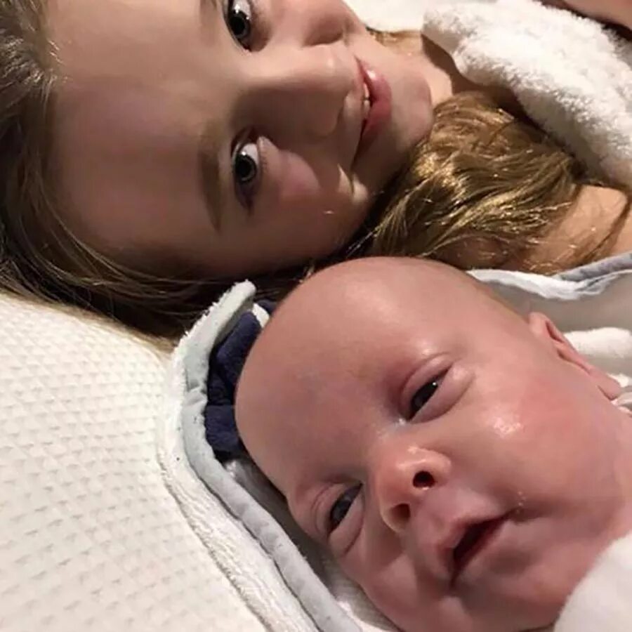 нейропатический акродерматит. новорожденные дети. переноношенный новорожденный.