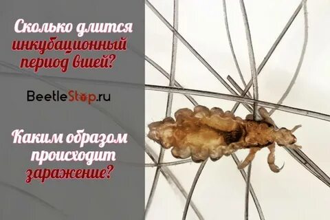 Как происходит заражение головными вшами