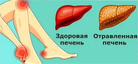 Боль в ногах печень