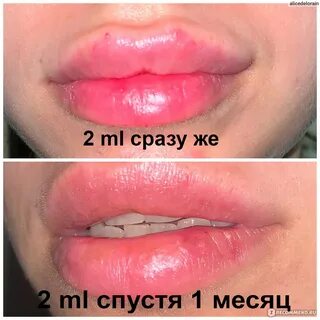 Стеллаж для губ