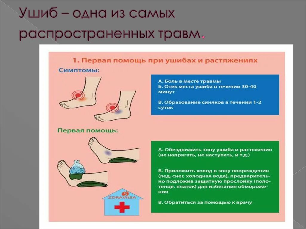 Памятка оказание первой помощи при ушибах. Оказание первой помощи при ушибах и растяжениях. Ушибы памятка.