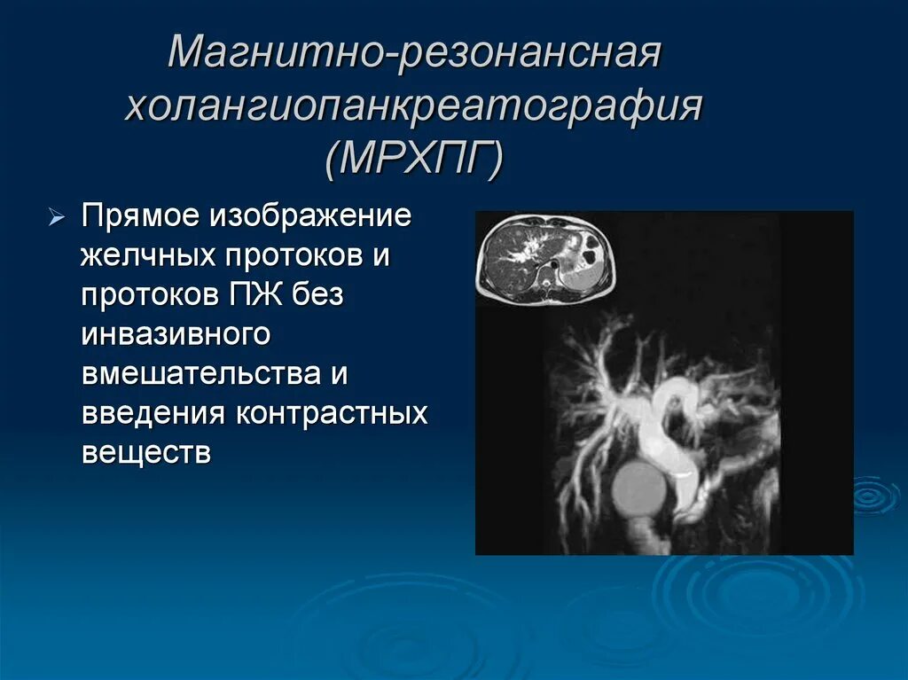 Магнитно-резонансная панкреатохолангиография. Магнитно-резонансная холецистопанкреатография. Магнитнорезонансная холепанкреография.