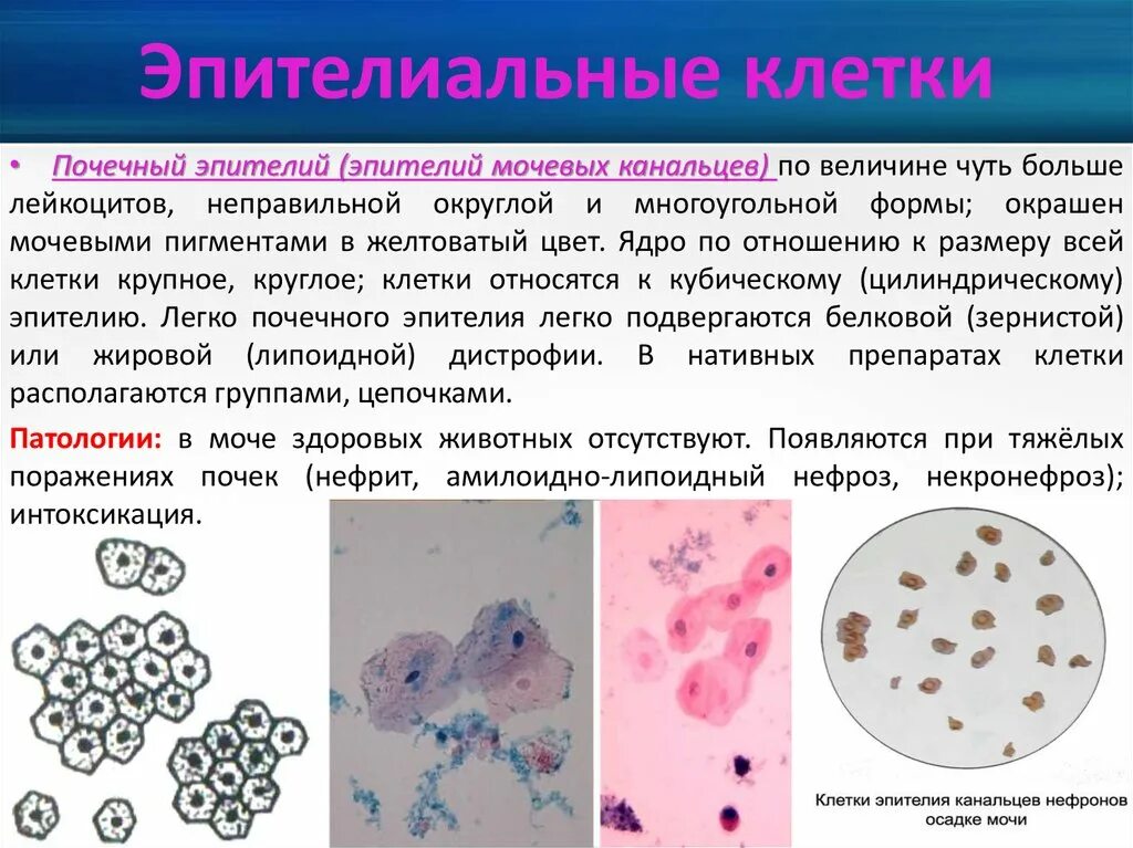 Повышенный эпителий в моче у мужчин. Плоский почечный эпителий в моче. Клетки эпителия в осадке мочи. Клетки почечного и переходного эпителия в моче. Почечный эпителий и лейкоциты в моче.