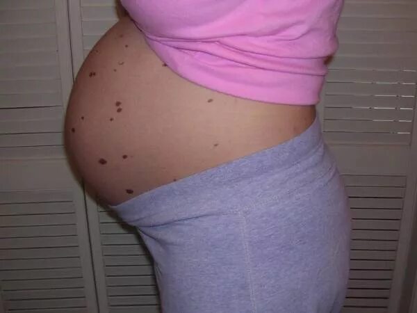 Беременный живот. Живот при беременности. 36 1 неделя беременности